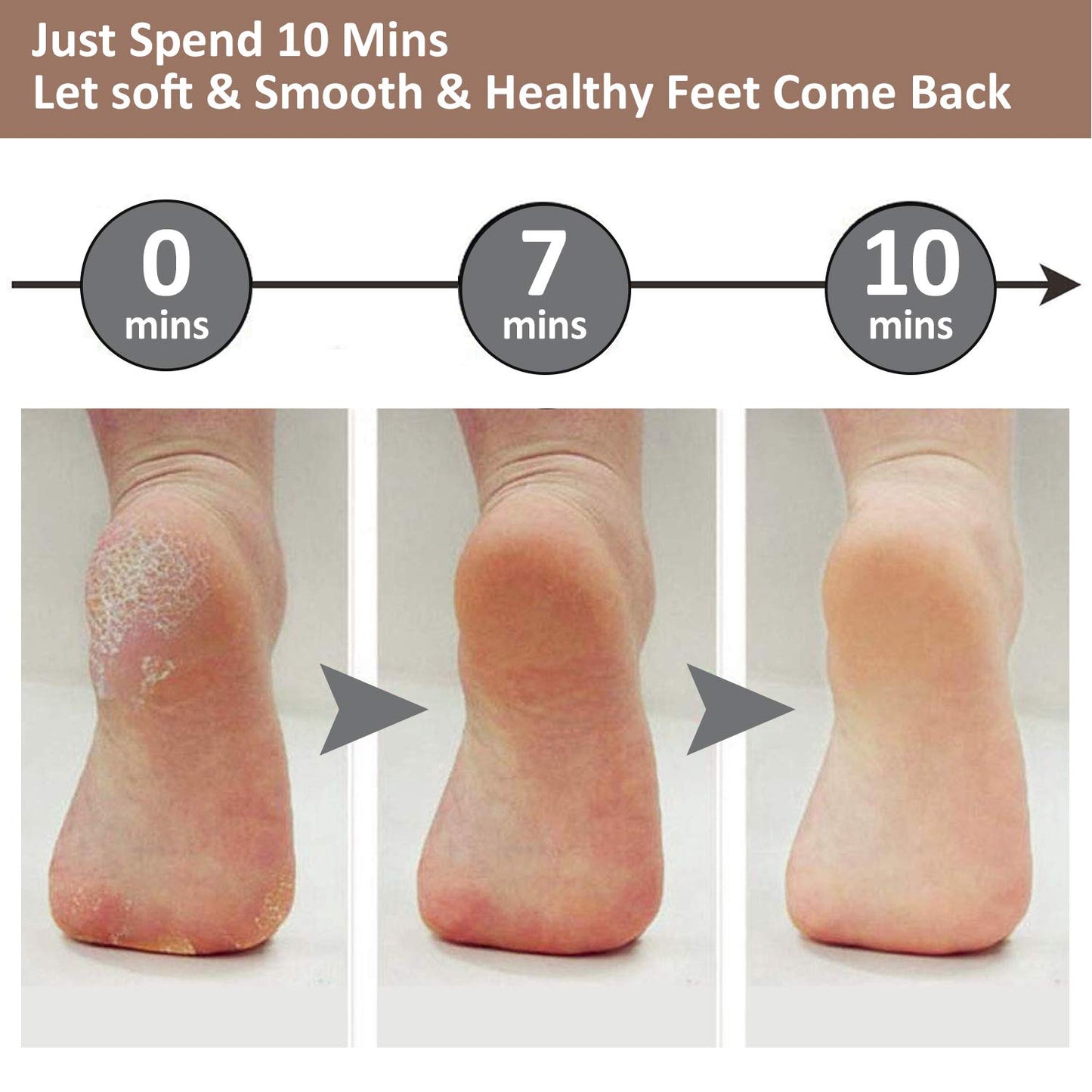 Electric Foot File Grinder Dead Dry Skin Callus Remover USB Rechargeable Feet Pedicure Tool With 2 Replaceable roller heads 電動腳部乾死皮打磨去除器+可更換滾輪頭2個套裝